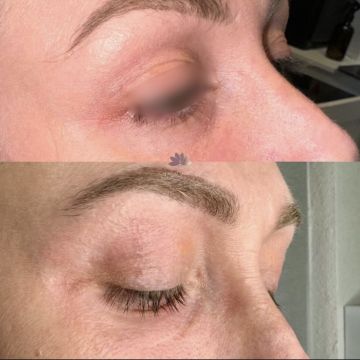 I work off commission at ZenVida Wellness & Aesthetics - Samaná - Skin Cleansing