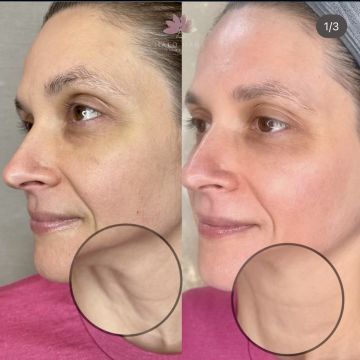 I work off commission at ZenVida Wellness & Aesthetics - Samaná - Beauty services