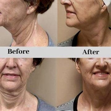 I work off commission at ZenVida Wellness & Aesthetics - Samaná - Beauty services