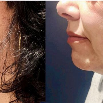 I work off commission at ZenVida Wellness & Aesthetics - Samaná - Beauty services