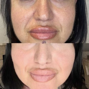 I work off commission at ZenVida Wellness & Aesthetics - Samaná - Beauty services