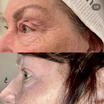 I work off commission at ZenVida Wellness & Aesthetics - Samaná - Beauty services