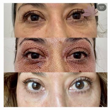 I work off commission at ZenVida Wellness & Aesthetics - Samaná - Beauty services