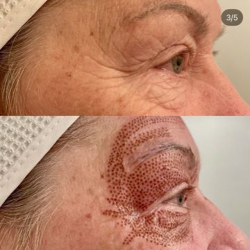 I work off commission at ZenVida Wellness & Aesthetics - Samaná - Skin Cleansing