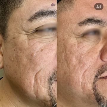 I work off commission at ZenVida Wellness & Aesthetics - Samaná - Beauty services