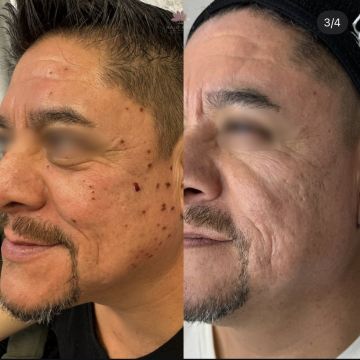 I work off commission at ZenVida Wellness & Aesthetics - Samaná - Skin Cleansing