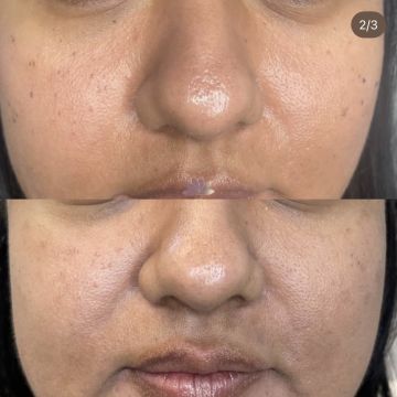 I work off commission at ZenVida Wellness & Aesthetics - Samaná - Beauty services
