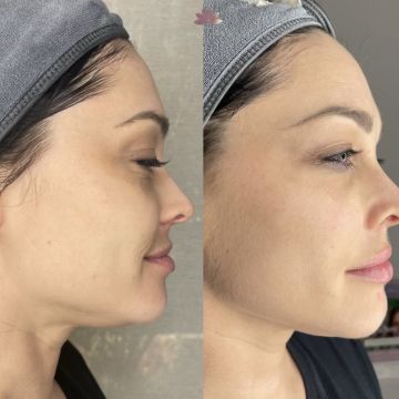 I work off commission at ZenVida Wellness & Aesthetics - Samaná - Skin Cleansing