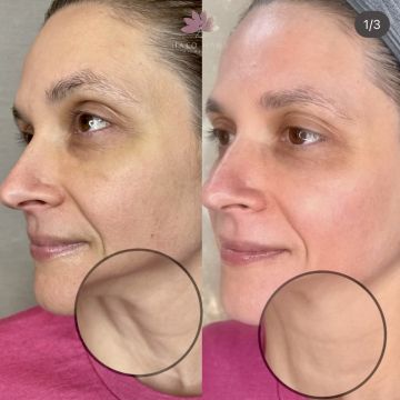 I work off commission at ZenVida Wellness & Aesthetics - Samaná - Beauty services