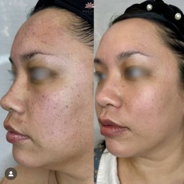 I work off commission at ZenVida Wellness & Aesthetics - Samaná - Beauty services