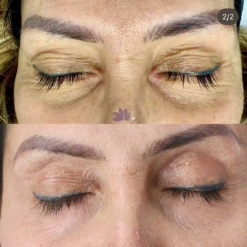 I work off commission at ZenVida Wellness & Aesthetics - Samaná - Skin Cleansing