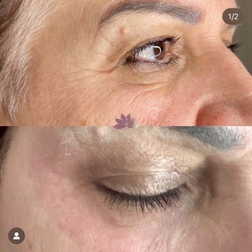 I work off commission at ZenVida Wellness & Aesthetics - Samaná - Beauty services