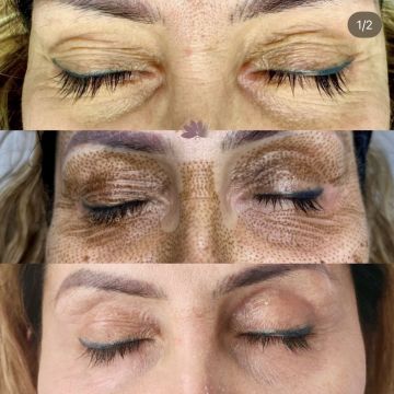 I work off commission at ZenVida Wellness & Aesthetics - Samaná - Beauty services