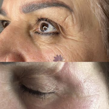 I work off commission at ZenVida Wellness & Aesthetics - Samaná - Skin Cleansing