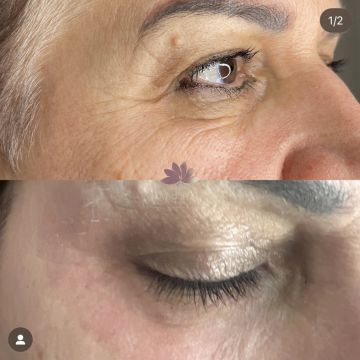 I work off commission at ZenVida Wellness & Aesthetics - Samaná - Skin Cleansing
