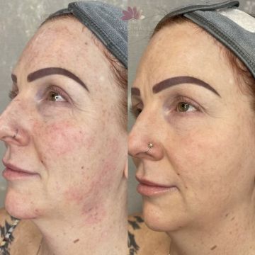 I work off commission at ZenVida Wellness & Aesthetics - Samaná - Beauty services
