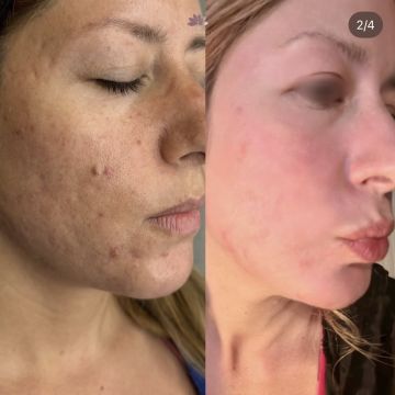 I work off commission at ZenVida Wellness & Aesthetics - Samaná - Beauty services