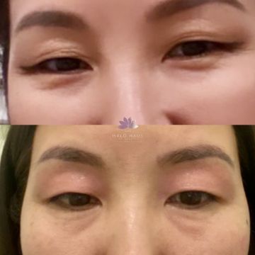 I work off commission at ZenVida Wellness & Aesthetics - Samaná - Skin Cleansing