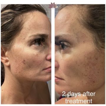 I work off commission at ZenVida Wellness & Aesthetics - Samaná - Beauty services