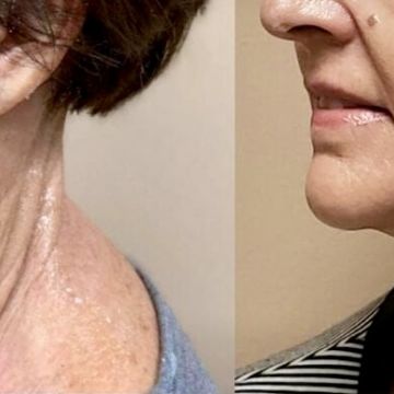 I work off commission at ZenVida Wellness & Aesthetics - Samaná - Beauty services