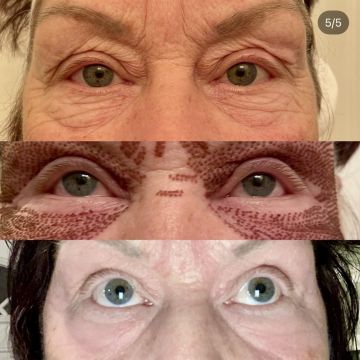 I work off commission at ZenVida Wellness & Aesthetics - Samaná - Skin Cleansing