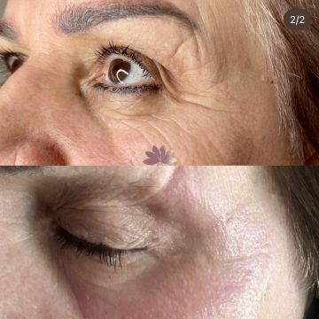 I work off commission at ZenVida Wellness & Aesthetics - Samaná - Skin Cleansing