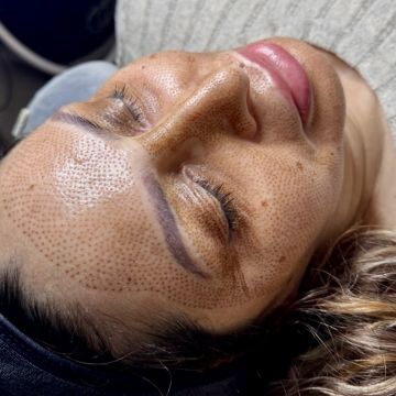 I work off commission at ZenVida Wellness & Aesthetics - Samaná - Skin Cleansing