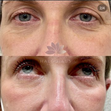 I work off commission at ZenVida Wellness & Aesthetics - Samaná - Skin Cleansing