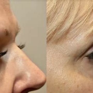 I work off commission at ZenVida Wellness & Aesthetics - Samaná - Beauty services