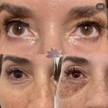 I work off commission at ZenVida Wellness & Aesthetics - Samaná - Beauty services