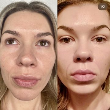 I work off commission at ZenVida Wellness & Aesthetics - Samaná - Beauty services