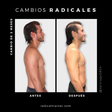 Radical Trainer - Madrid - TRX Suspension Training