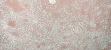 Mold Inspection and Removal