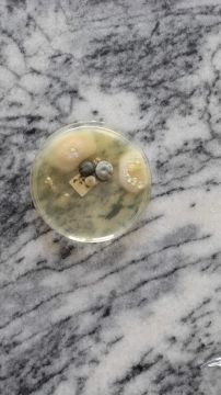 Mold Removal Expert