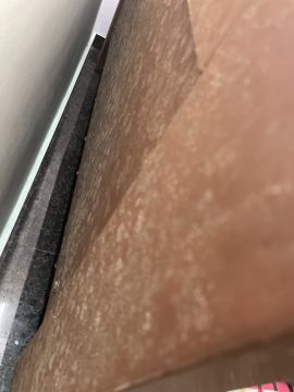 Mold Removal Expert