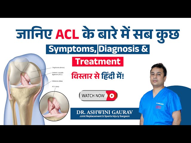 Dr. Ashwini Gaurav | Ortho Patna | Best Orthopedic Doctor in Patna | Arthritis Doctor & Best Joint Replacement Surgeon Patna - Sampatchak - Psychomotricity