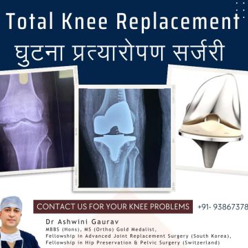 Dr. Ashwini Gaurav | Ortho Patna | Best Orthopedic Doctor in Patna | Arthritis Doctor & Best Joint Replacement Surgeon Patna - Sampatchak - Psychomotricity