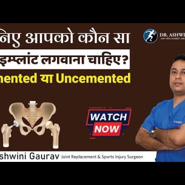 Dr. Ashwini Gaurav | Ortho Patna | Best Orthopedic Doctor in Patna | Arthritis Doctor & Best Joint Replacement Surgeon Patna - Sampatchak - Physiotherapy Sessions