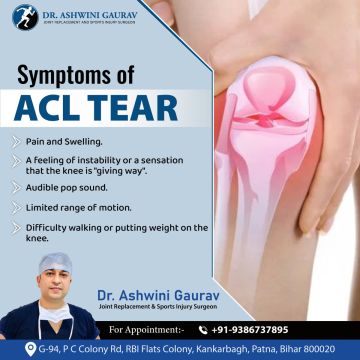 Dr. Ashwini Gaurav | Ortho Patna | Best Orthopedic Doctor in Patna | Arthritis Doctor & Best Joint Replacement Surgeon Patna - Sampatchak - Physiotherapy Sessions