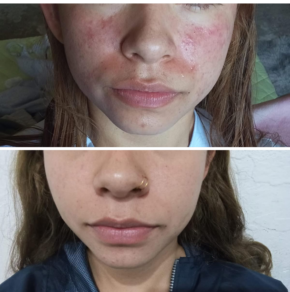 Clínica del niño Jesús - Teoloyucán - Homeopathy