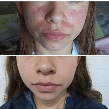 Clínica del niño Jesús - Teoloyucán - Homeopathy