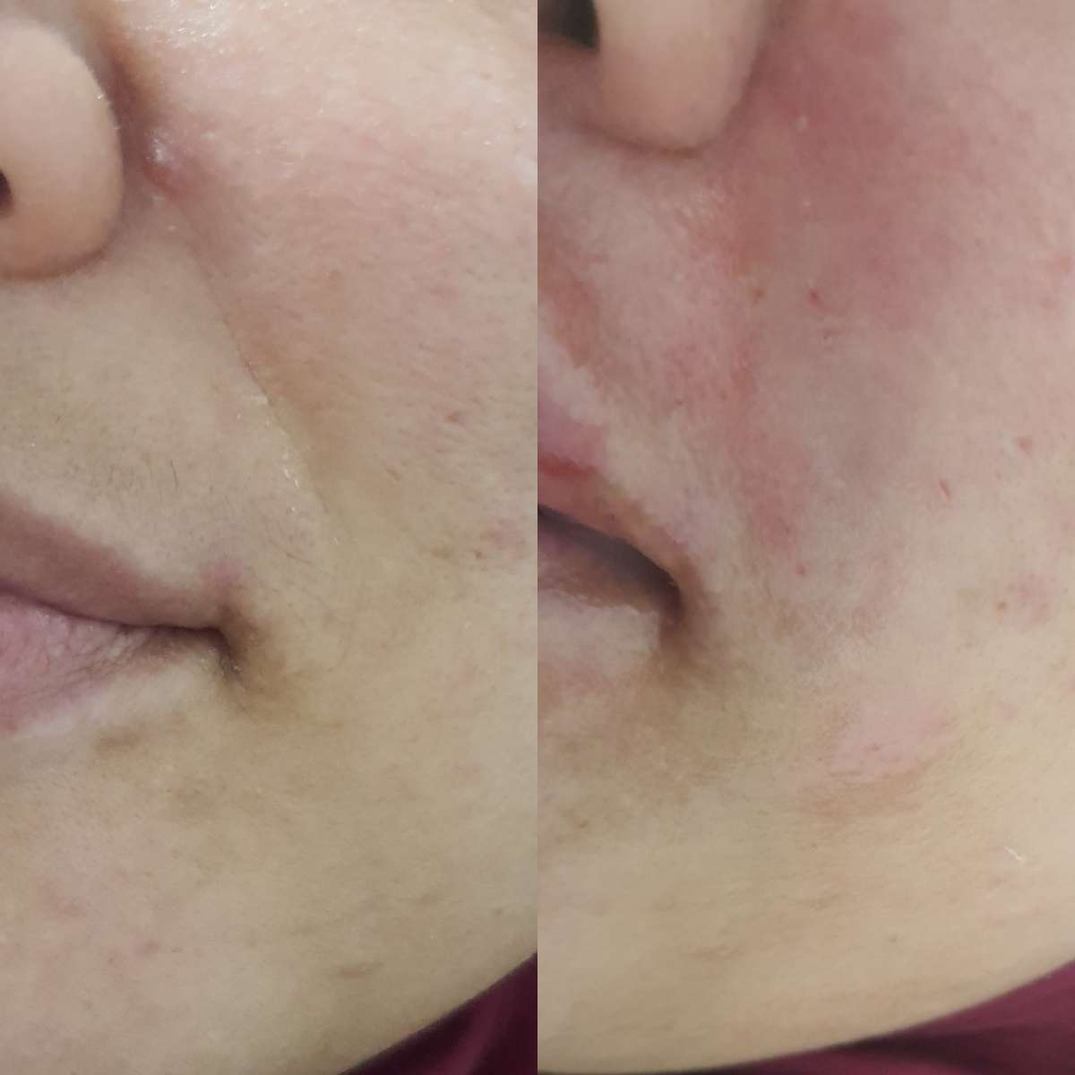 Raluca Beatrice MUA - Amadora - Skin Cleansing
