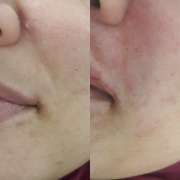 Raluca Beatrice MUA - Amadora - Skin Cleansing