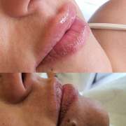 Raluca Beatrice MUA - Amadora - Hair Removal for Men