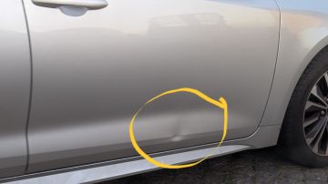 Dent Remover
