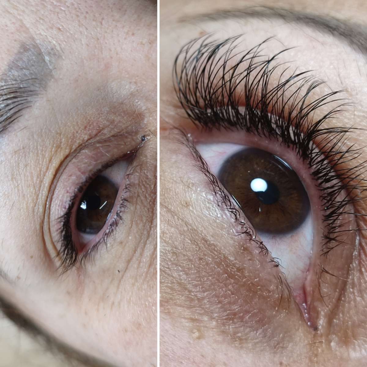 Suzana Pires Terapeuta Naturopata Integrativa e Holística - Matosinhos - Massagem Sueca