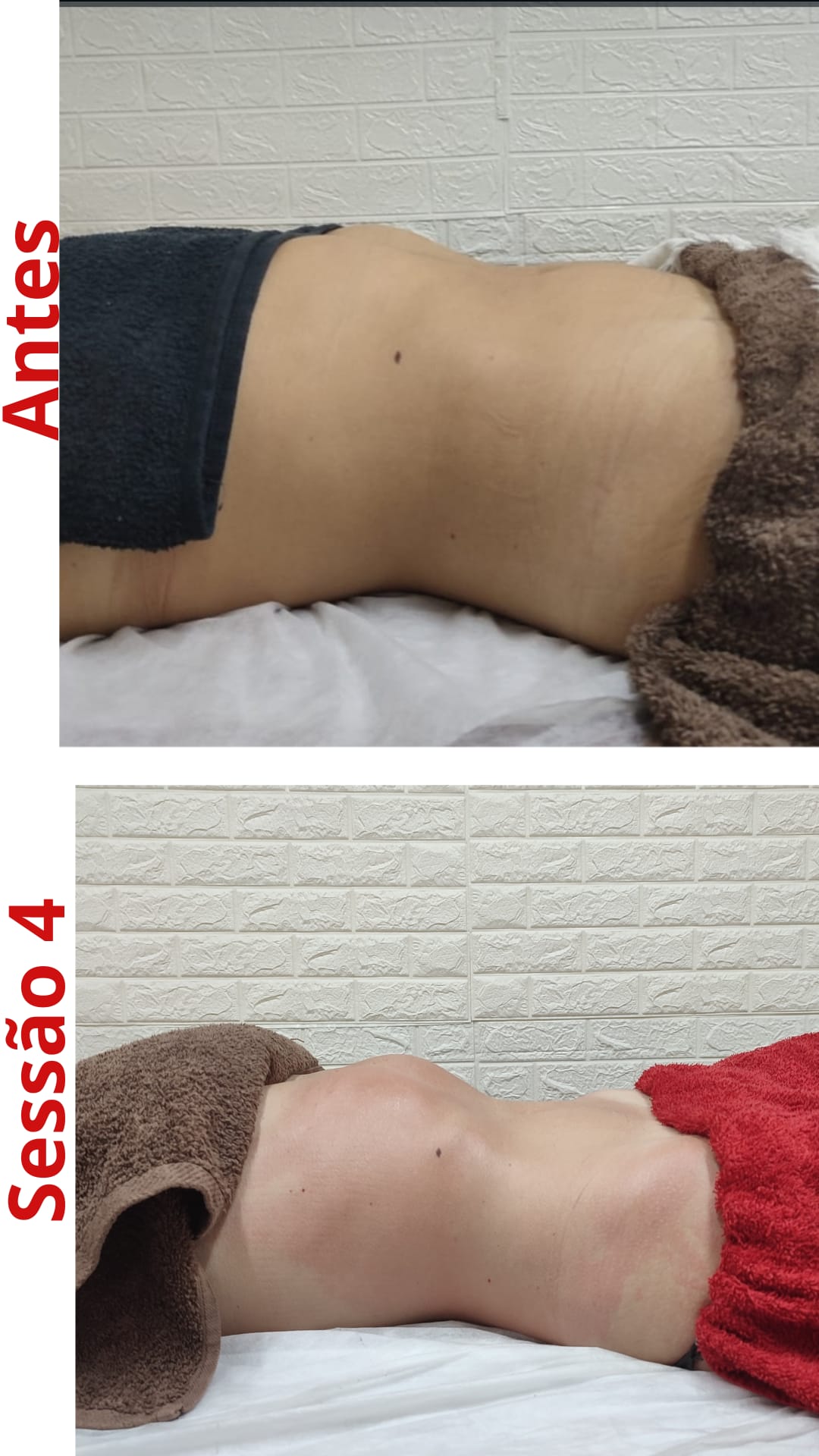 Suzana Pires Esteticista e Terapeuta de Massagens - Matosinhos - Massagem Desportiva
