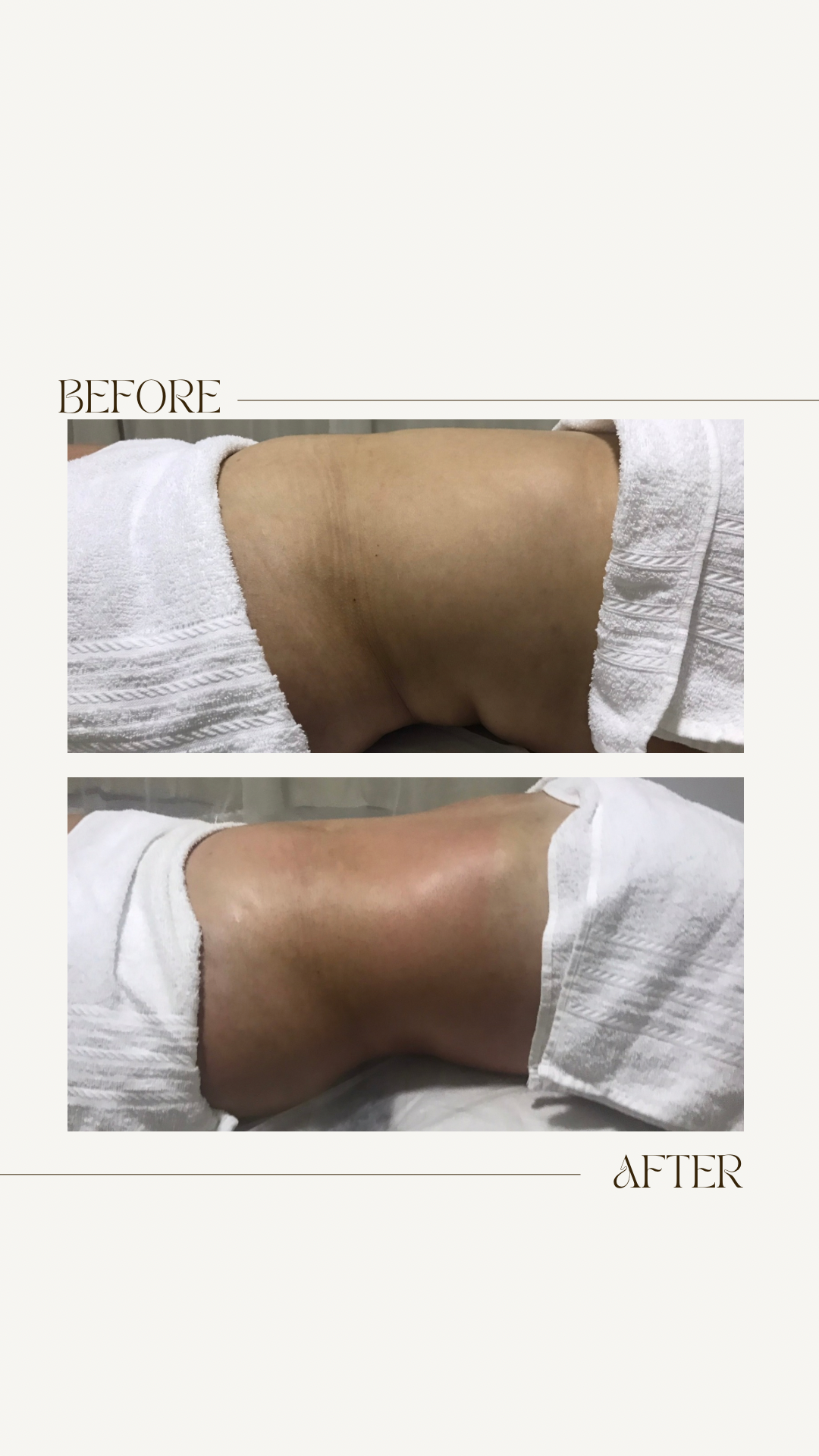 Lima Beauty - Loures - Deep Tissue Massage