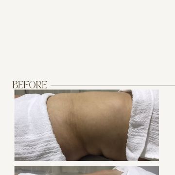 Lima Beauty - Loures - Deep Tissue Massage