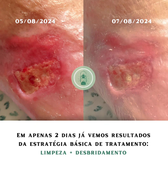 Enfermeira Ana Gentil - Coimbra - Cuidados de Saúde